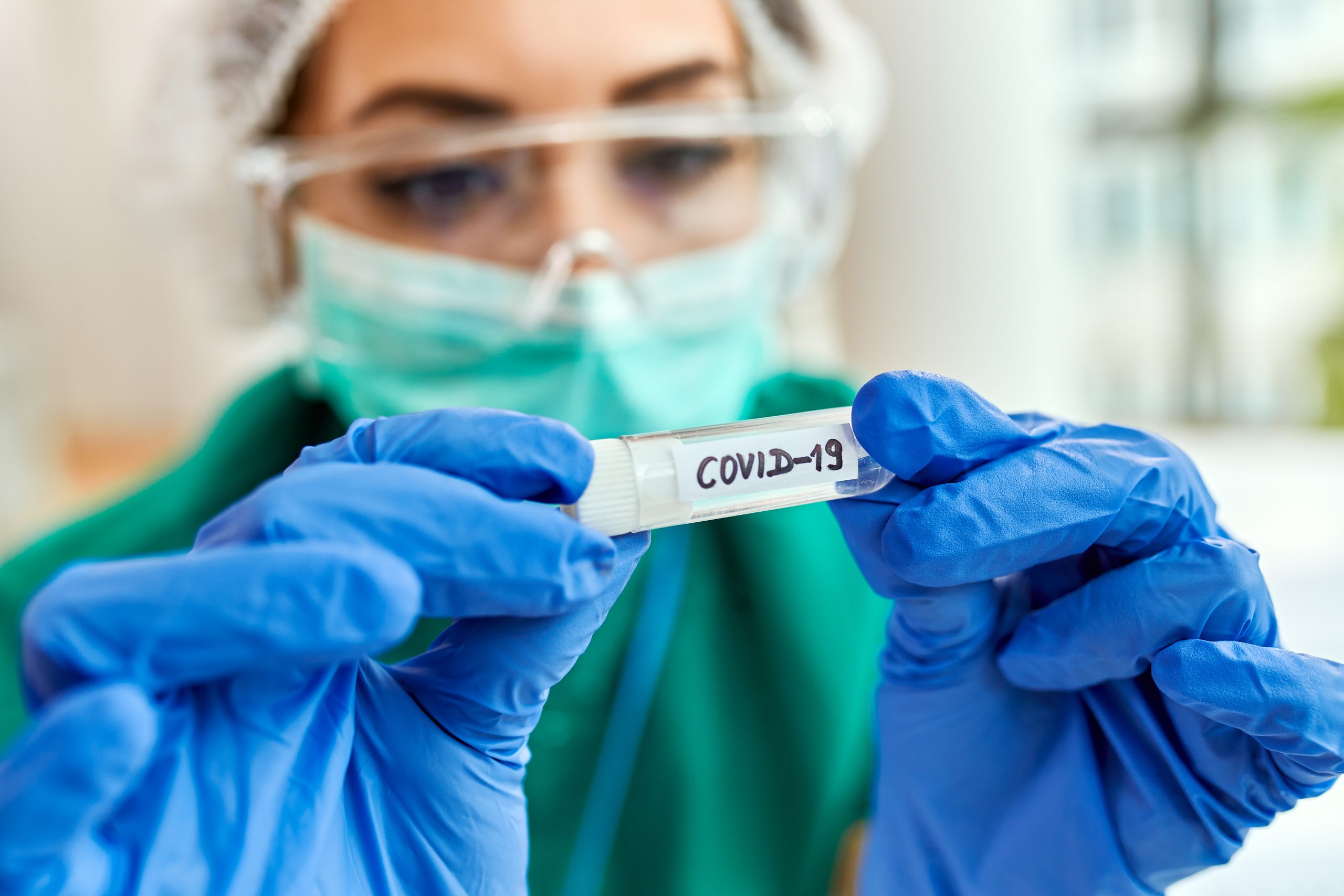 Close-up of epidemiologist with COVID-19 sample in test tube.
